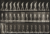 disseminated sclerosis, walking with cane.
