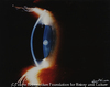 An eye seen from the side
