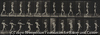 a: bow-legs, boy; b: spinal caries, girl walking.