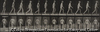 lateral curvature of spine, walking.