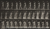 multiple cerebro-spinal sclerosis choreic, walking.